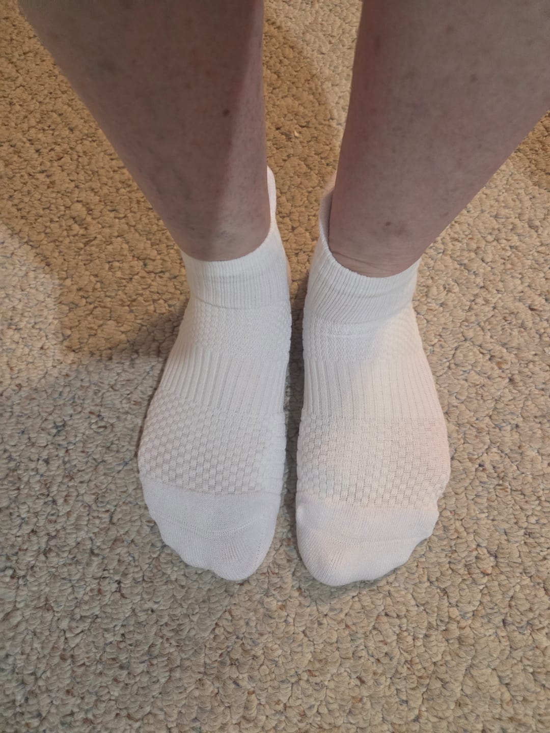 Customer photo review of White Ankle Compression Socks 5-Pack Bundle
