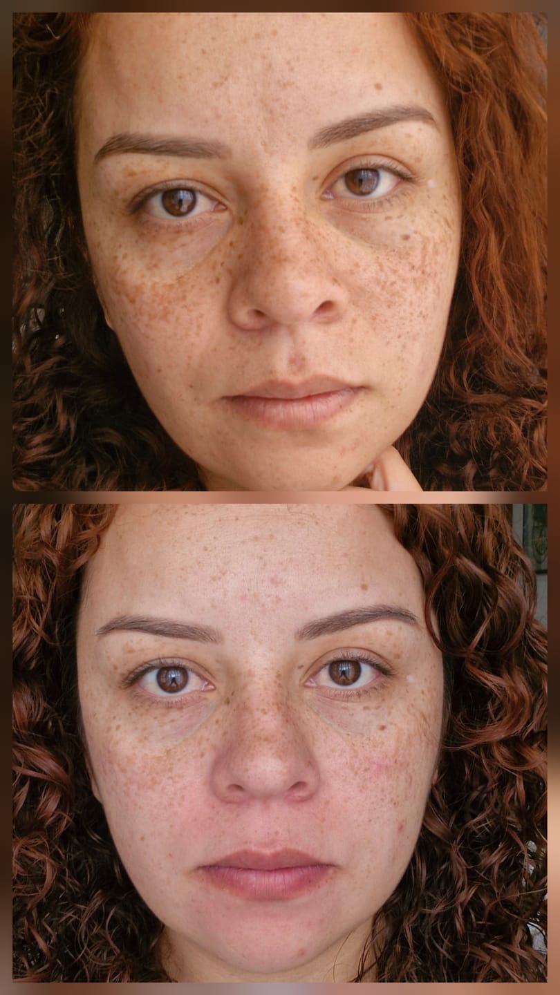 Customer photo review of Tónico Iluminador Aclarante
