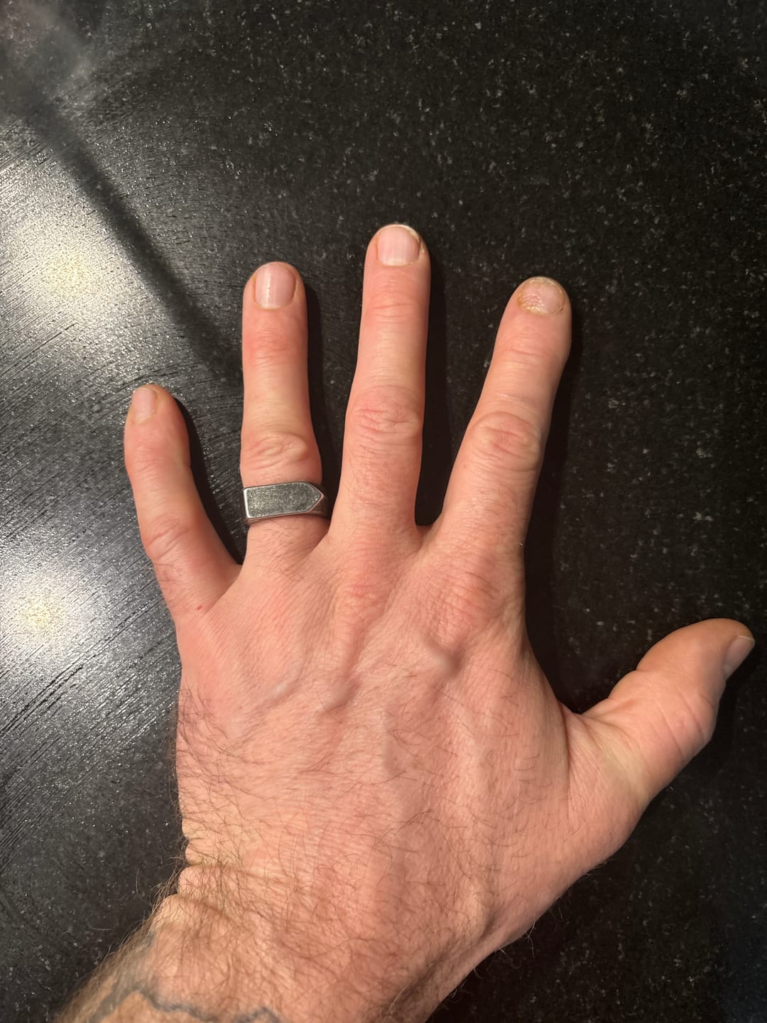 Customer photo review of ARROW. - GRAY