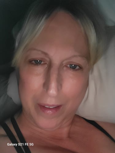 Close-up of a reviewer's face showing her skin after using F-Balm tallow balm.