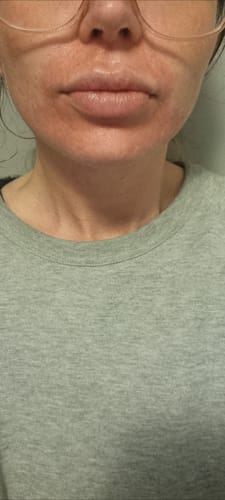 Customer photo review of Seb Natural Calming Serum