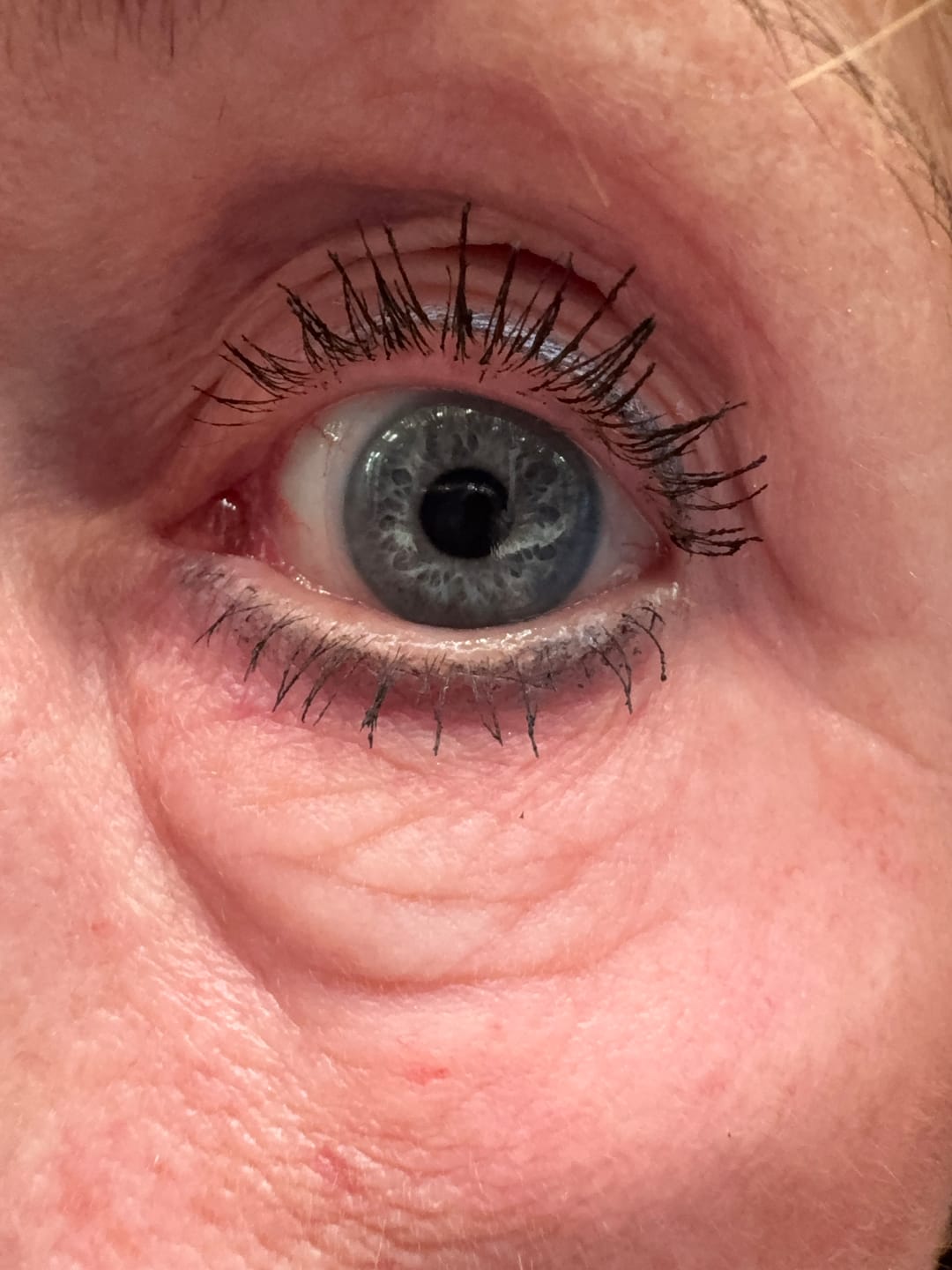 Customer photo review of Wimpernserum