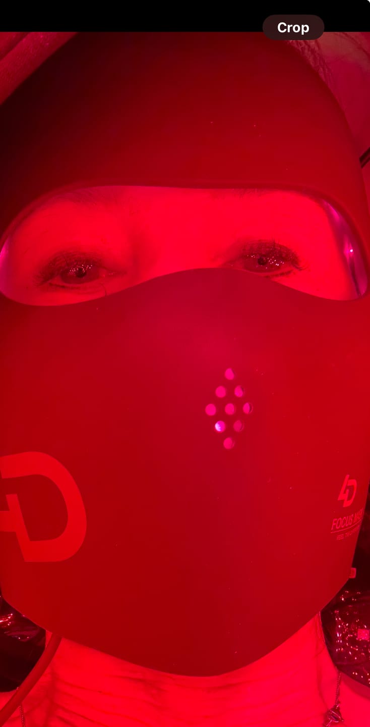 Customer photo review of JOVS 4D Laser Anti-Aging Therapy Mask