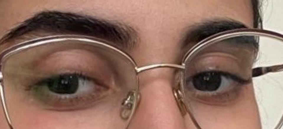 Customer photo review of WIMPERNSERUM
