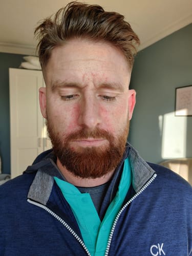 Customer photo review of Seb Natural Soothing Balm