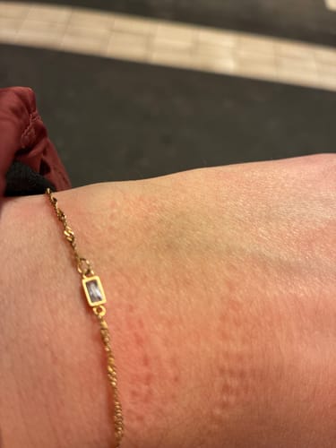 Customer photo review of Permanent Armband - dein everbond in Berlin