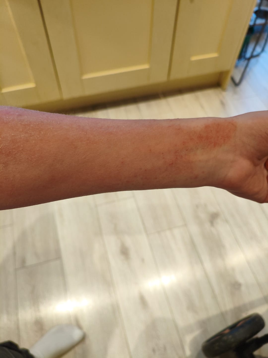 Customer photo review of Bioskin Junior Duo Pack
