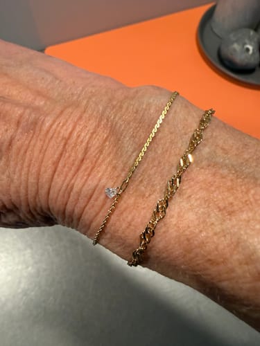 Customer photo review of Permanent Armband - dein everbond in Köln