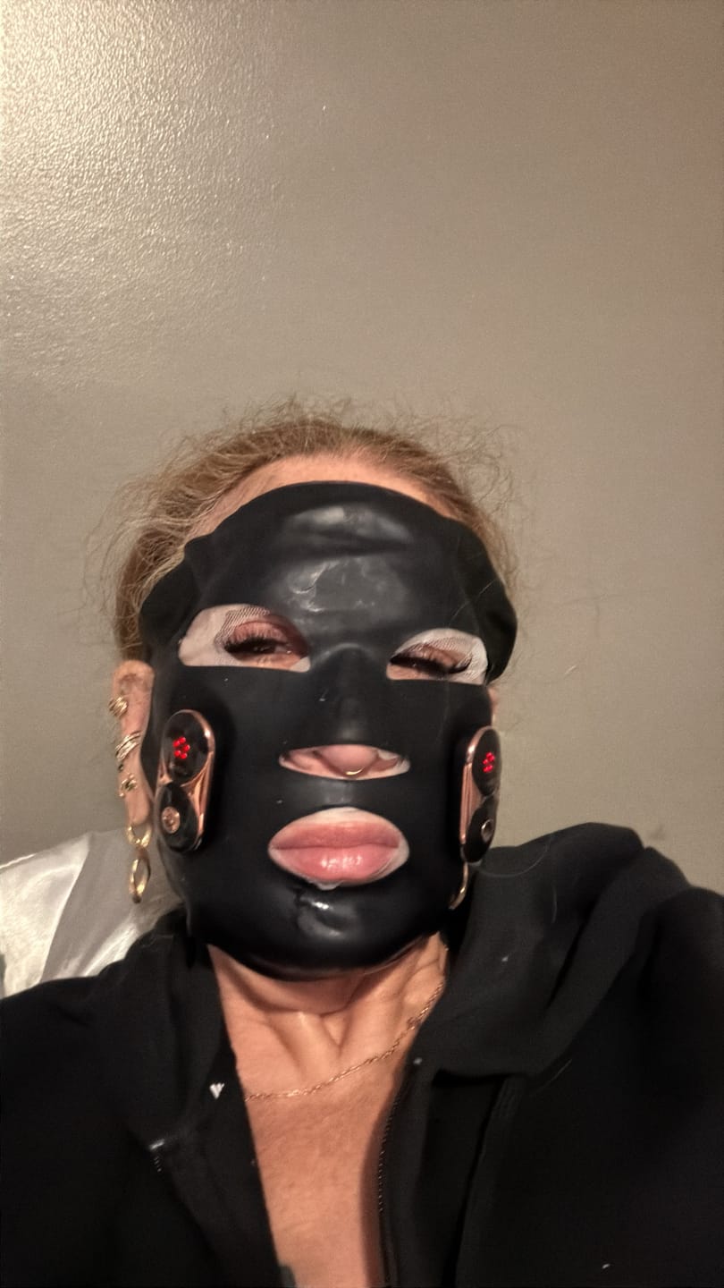 Customer photo review of JOVS EMS-Lifting Mask