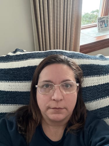Reviewer's selfie showing her skin as she begins her treatment with the Seranova Micro Infusion System.