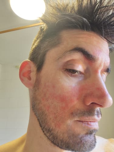 Customer photo review of Seb Natural Calming Serum