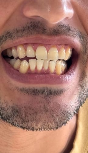 Customer photo review of LUX-White - Weisse Zähne, Schönes Lächeln