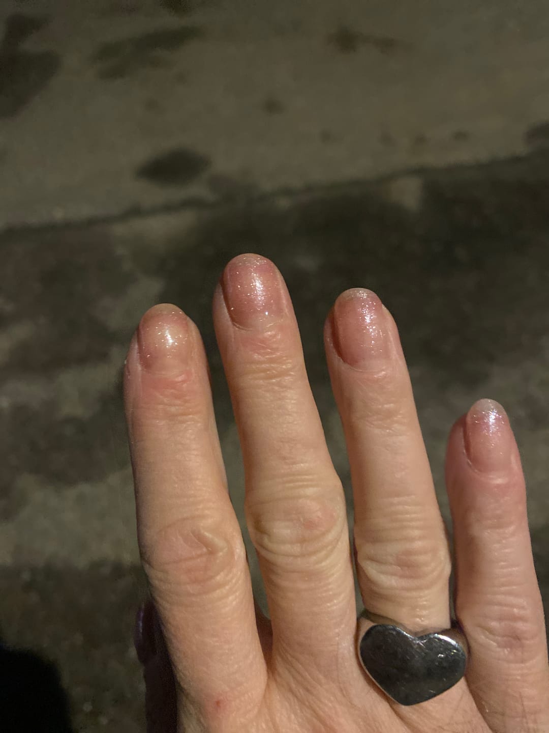 Customer photo review of LCI Combo Pack: Base Coat DryFix 10 ml + Top Coat DryFix 10 ml