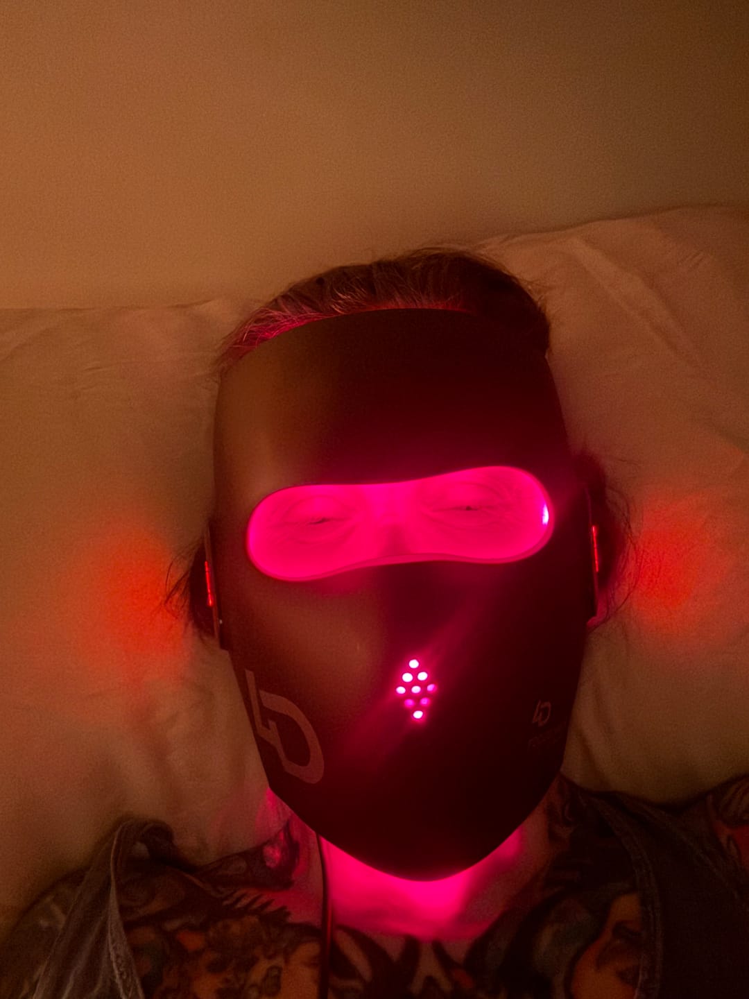 Customer photo review of JOVS 4D Laser Anti-Aging Therapy Mask