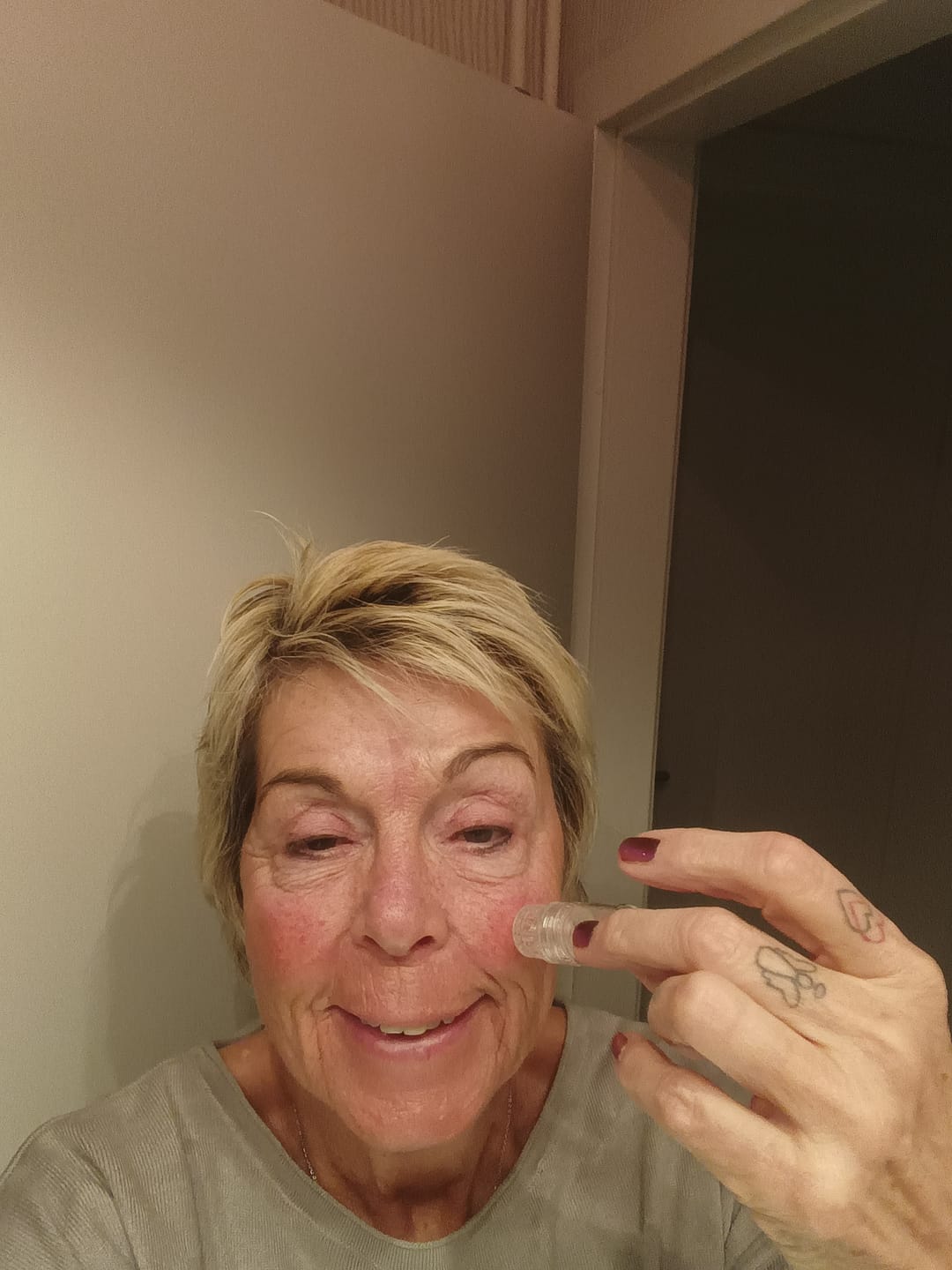 Customer photo review of Seranova Micro Infusion System™