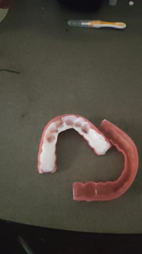 Customer photo review of 🦷  Fit Full Functional DenturesMake you more confident-Made in the USA & FDA-Certified