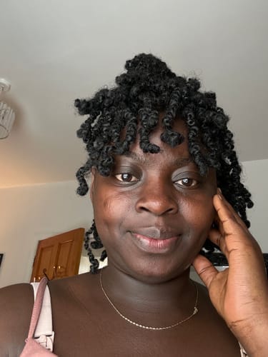 Customer photo review of Anti-Acne & Dark Spots Bar