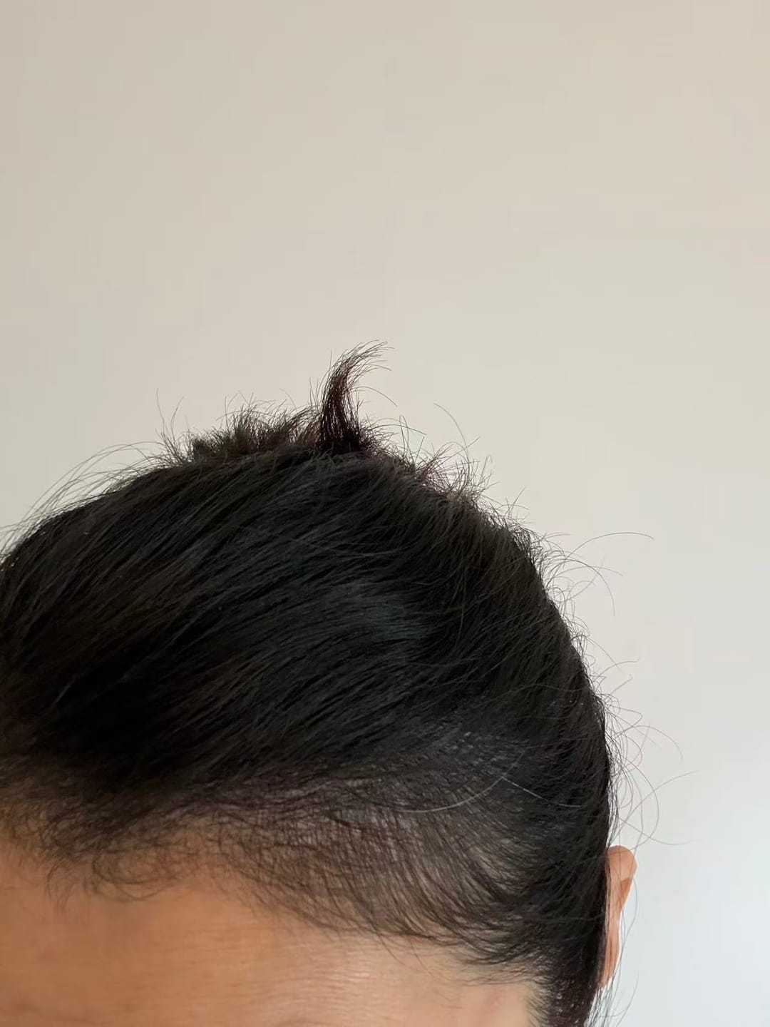 Customer photo review of [IN] Youth - Cure antichute cheveux