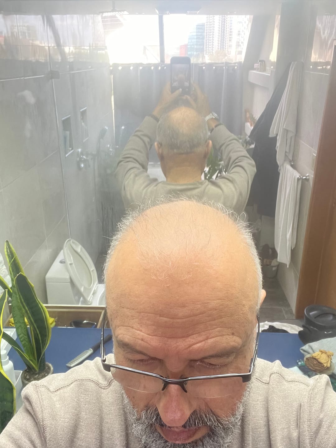 Customer photo review of Micro Infusion System ck-s6m