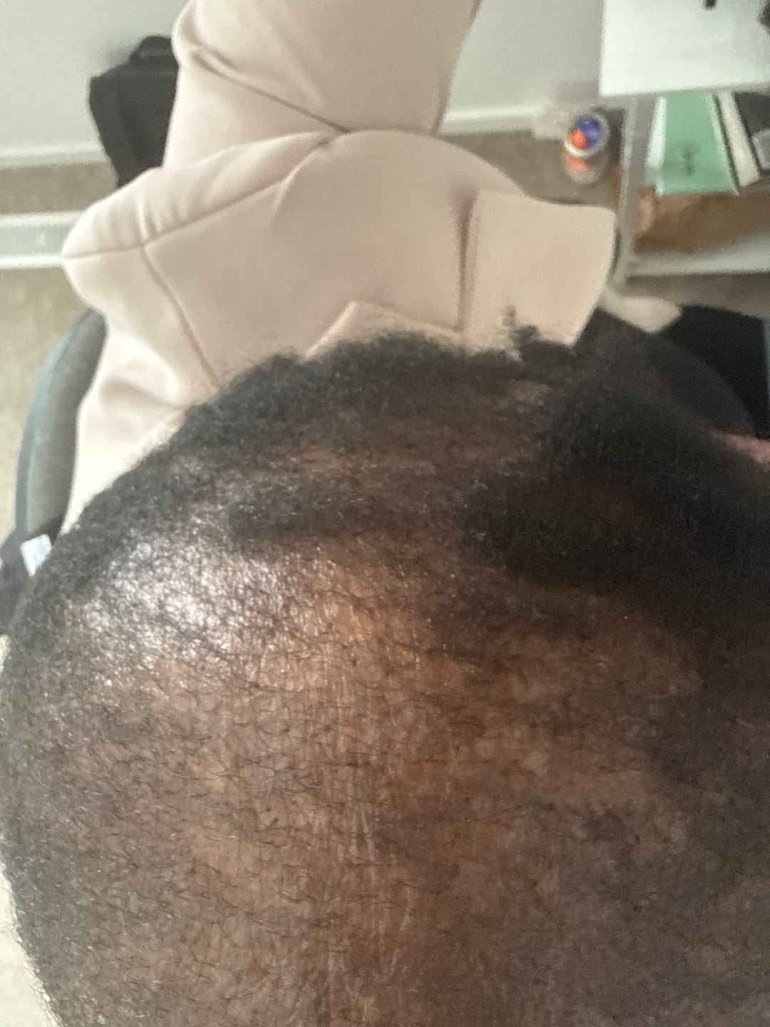Customer photo review of Growth Stimulation Bundle