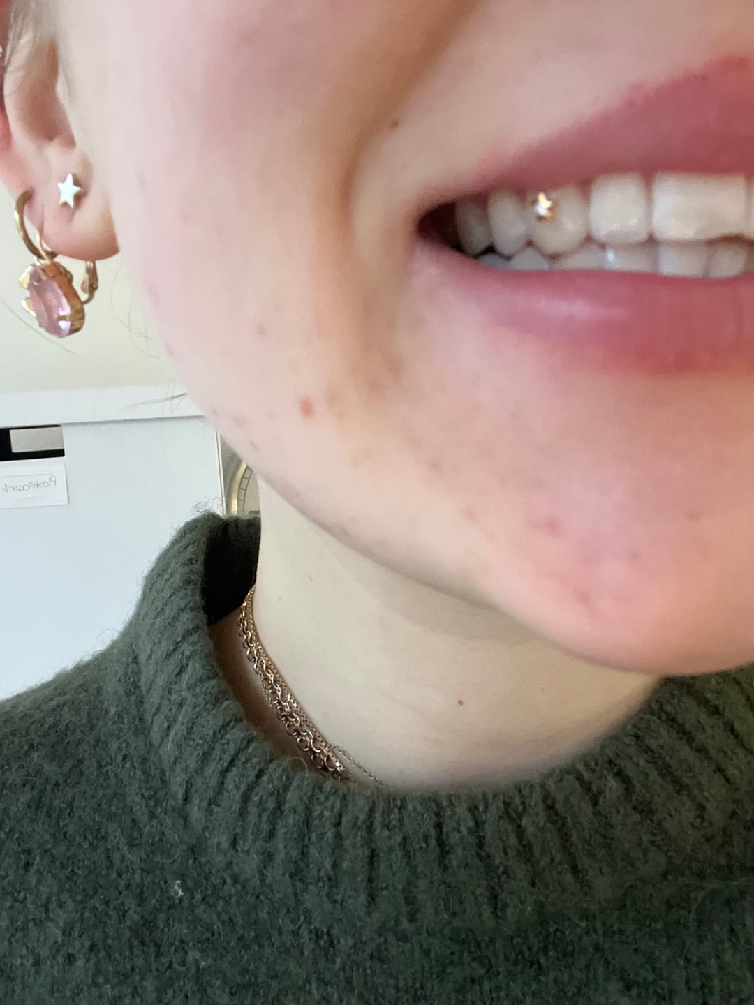 Customer photo review of Star w. Diamond 22-karat gold