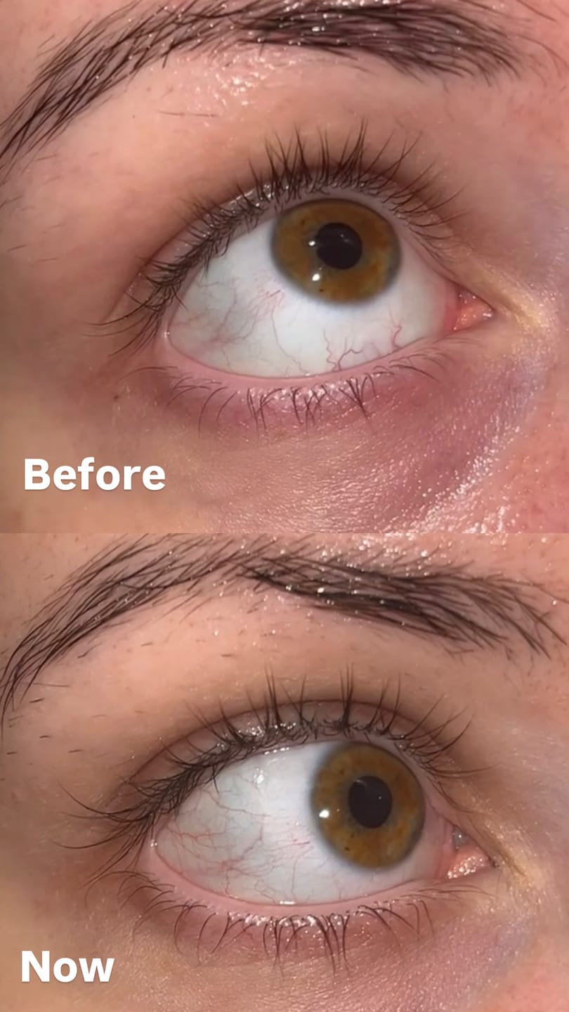 Customer photo review of WIMPERNSERUM