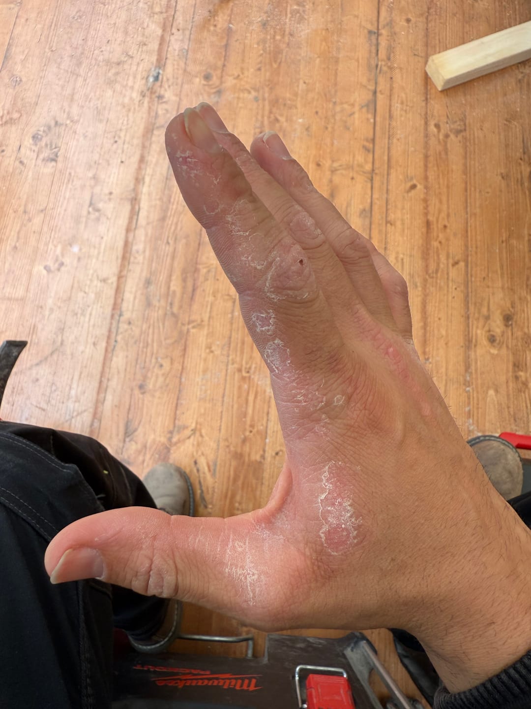 Customer photo review of Bioskin Duo Pack