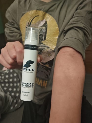 Vásárló mutatja a SERENI pikkelysömör és ekcéma krémet és a mellette lévő, tiszta bőrű alkarját.