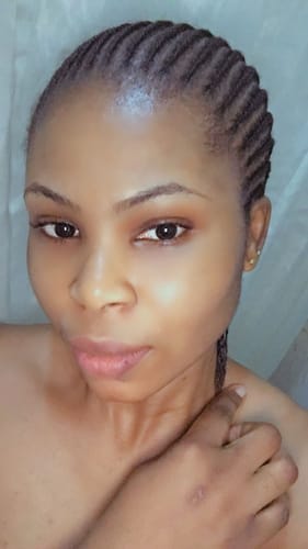 Customer photo review of Anti-Acne & Dark Spots Bar
