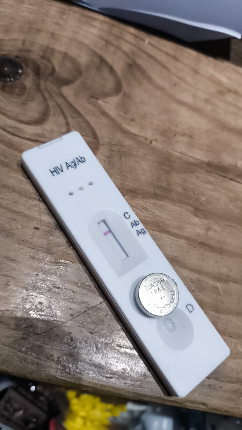 Customer photo review of STD自宅検査｜HIV(エイズ) 検査キット