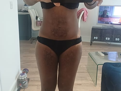 Customer photo review of Anti-Acne & Dark Spots Bar