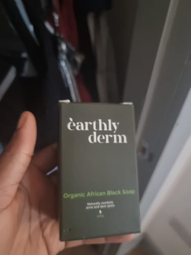 Customer photo review of Anti-Acne & Dark Spots Bar