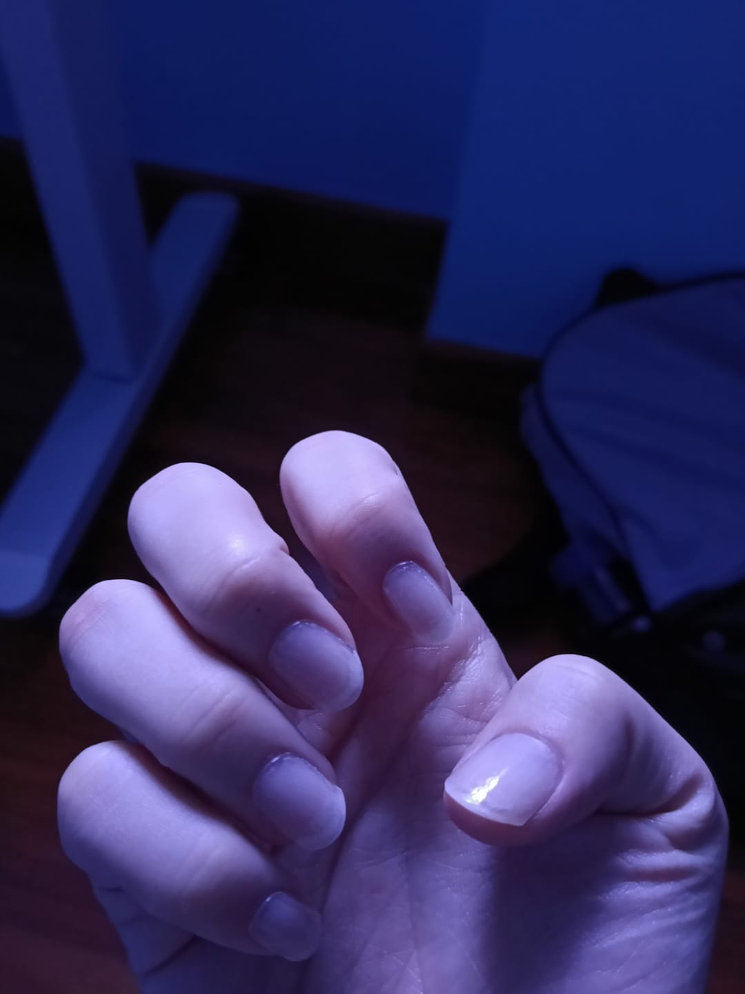 Customer photo review of Crystal Clear DIY Semicured Gel Nail Sticker Kit (STOP NAIL BITING & GROW BRITTLE NAILS)