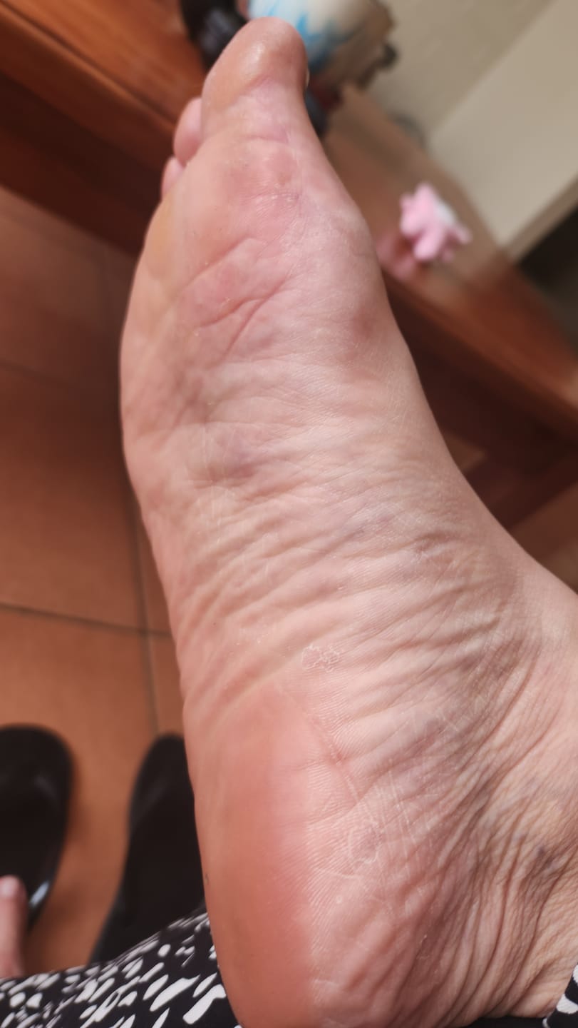 Customer photo review of Kit Hidratación Extrema – Crema + Barra Reparadora para Pies