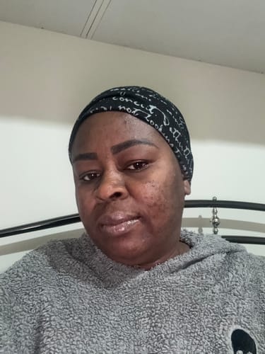 Customer photo review of Anti-Acne & Dark Spots Bar