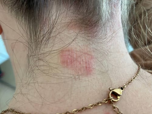 Customer photo review of Seb Natural Calming Serum