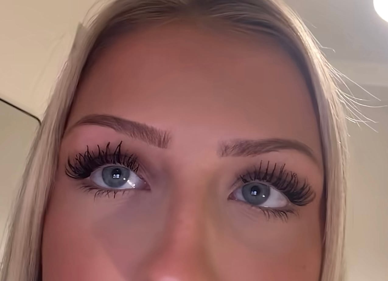 Customer photo review of RIPSIENKASVUSEERUMI