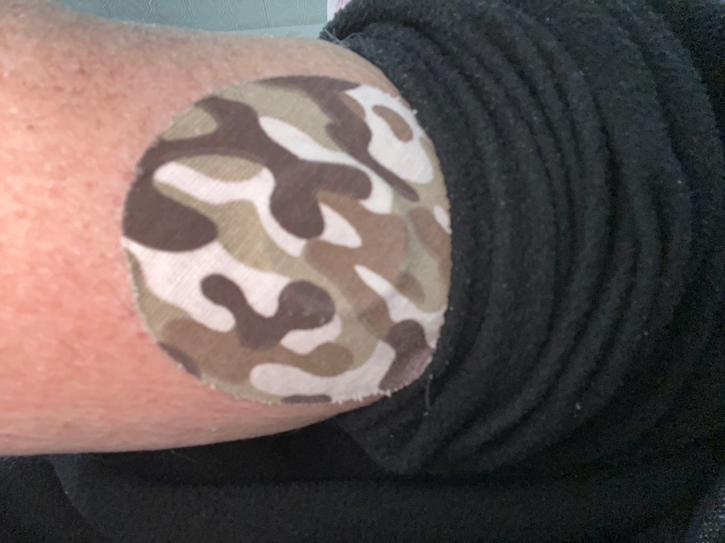 Customer photo review of Skin Grip Original - Freestyle Libre 2+ & Lingo Adhesive Patches