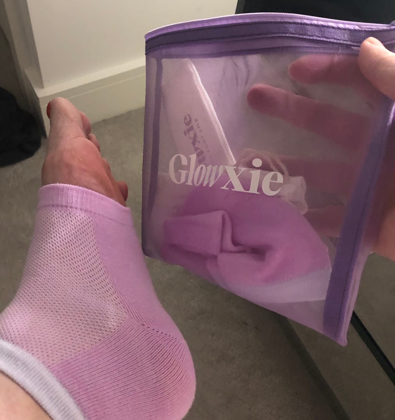 Customer photo review of Glowxie Deluxe Pedi Set - XL File, Scrub & Heel Socks