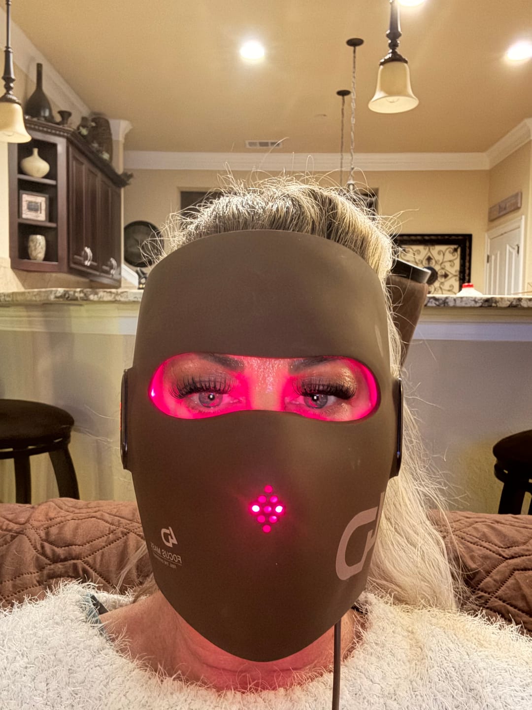 Customer photo review of JOVS 4D Laser Light Therapy Mask