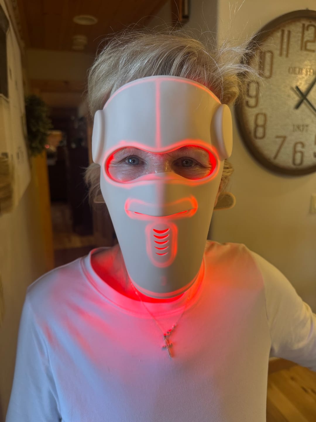 Customer photo review of Hatch Halo™ Dermatologist Grade 3-in-1 Light Therapy Mask