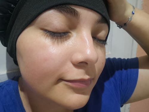 Customer photo review of D-Panthenol Barrier Soothing Cream