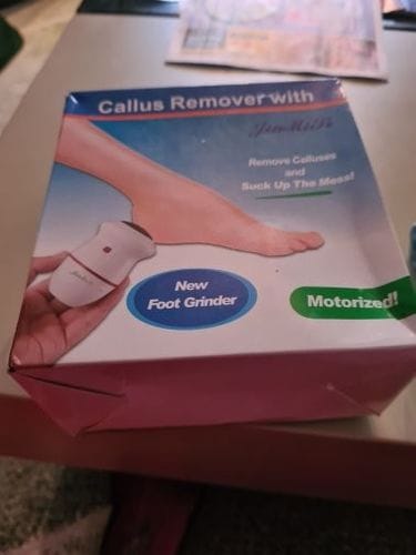 Customer photo review of FeetCARE PRO™ | Fjerner Hard Hud Raskt & Effektivt