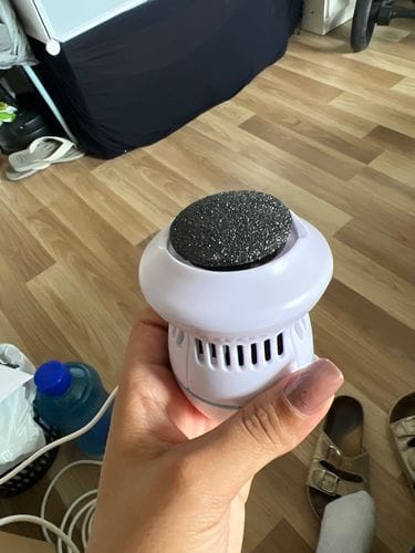 Customer photo review of FeetCARE PRO™ | Fjerner Hard Hud Raskt & Effektivt