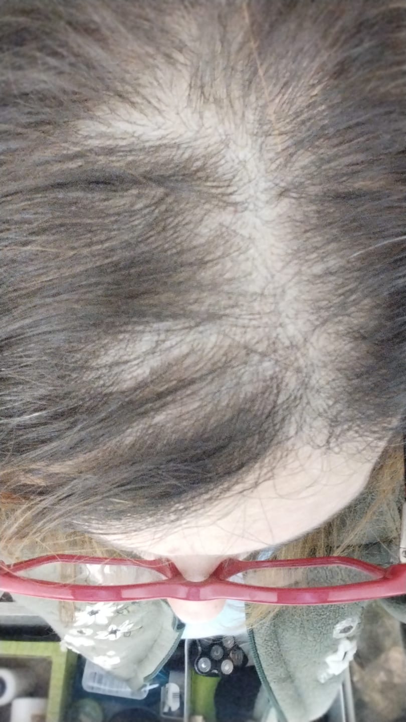 Customer photo review of E·PHI MINI DUO | Ripara & Sigilla