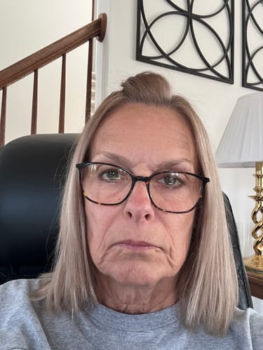 Reviewer's before-photo showing facial wrinkles and jowls prior to using The Micro Infusion System.