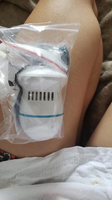 Customer photo review of FeetCARE PRO™ | Fjerner Hard Hud Raskt & Effektivt