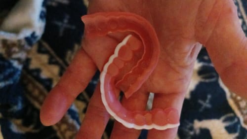 Customer photo review of 🦷  Fit Full Functional DenturesMake you more confident-Made in the USA & FDA-Certified