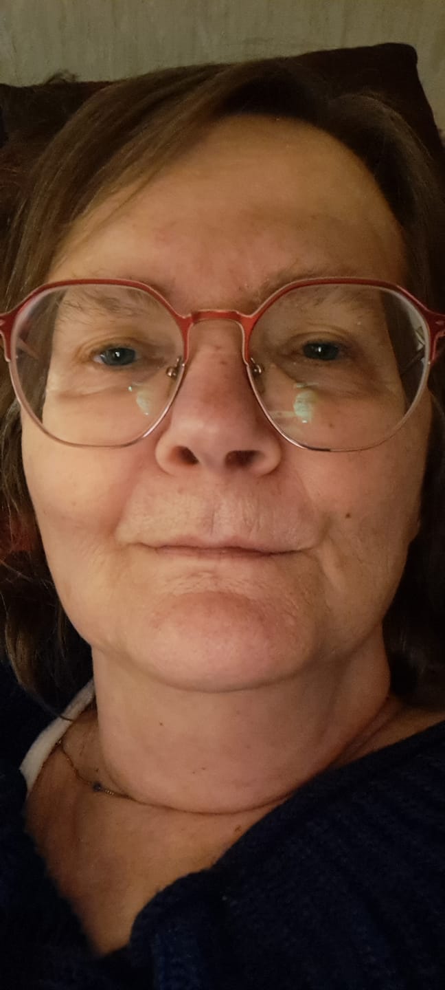 Customer photo review of Alua™- Collageen Proteine