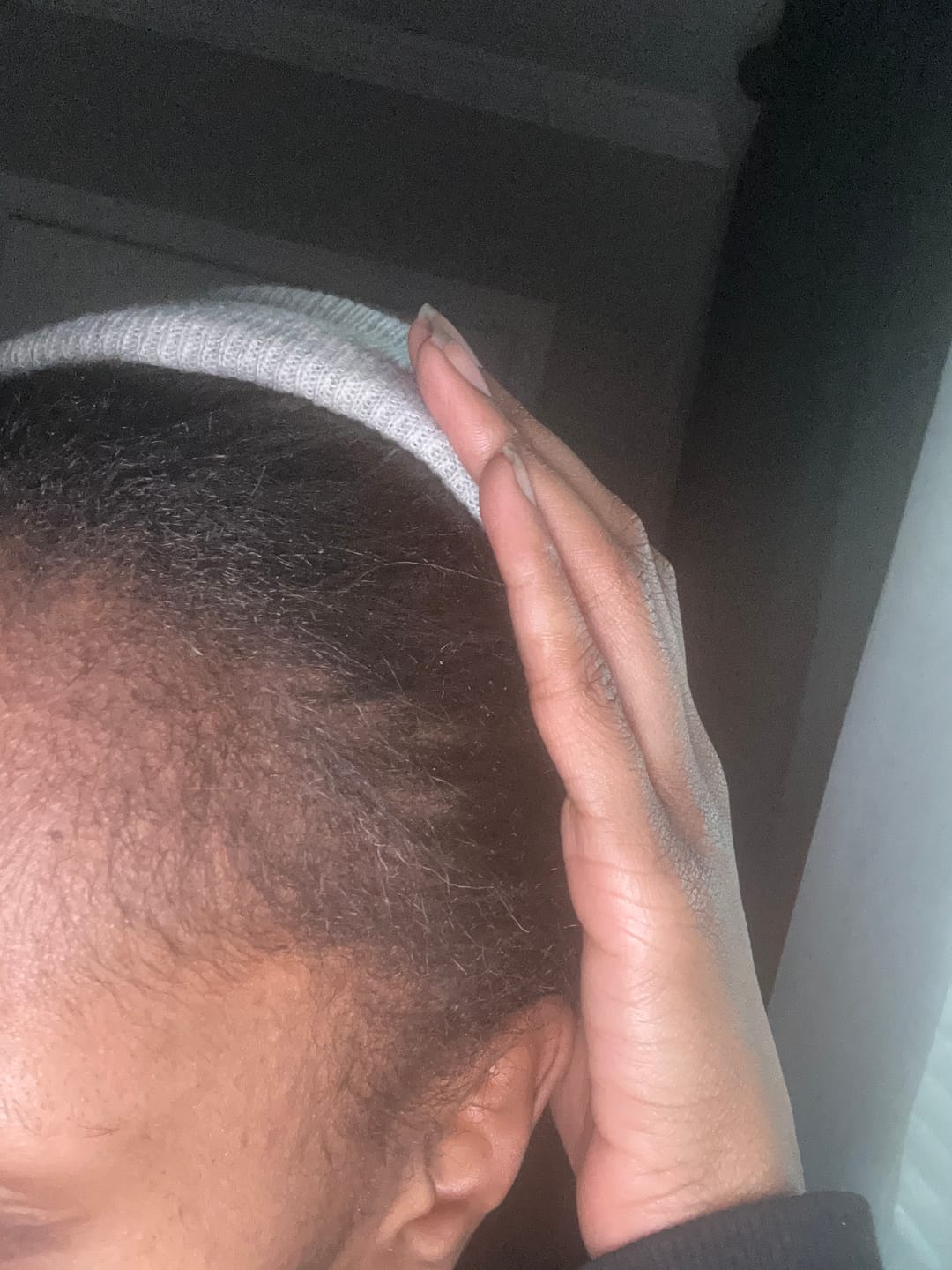 Customer photo review of Mini Herbal Hair Growth Oil